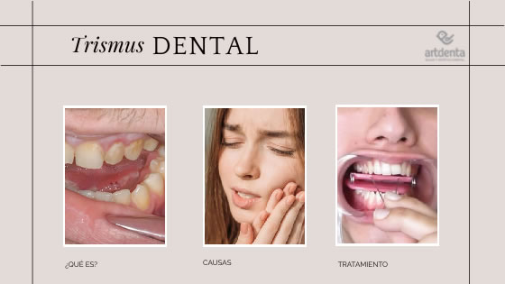 Banner Trismus Dental | Clínica Dental Artdenta