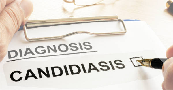 Candidiasis y Lengua Blanca | Clínica Dental Artdenta Valencia