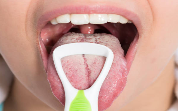 Limpieza y Lengua Blanca | Clínica Dental Artdenta Valencia