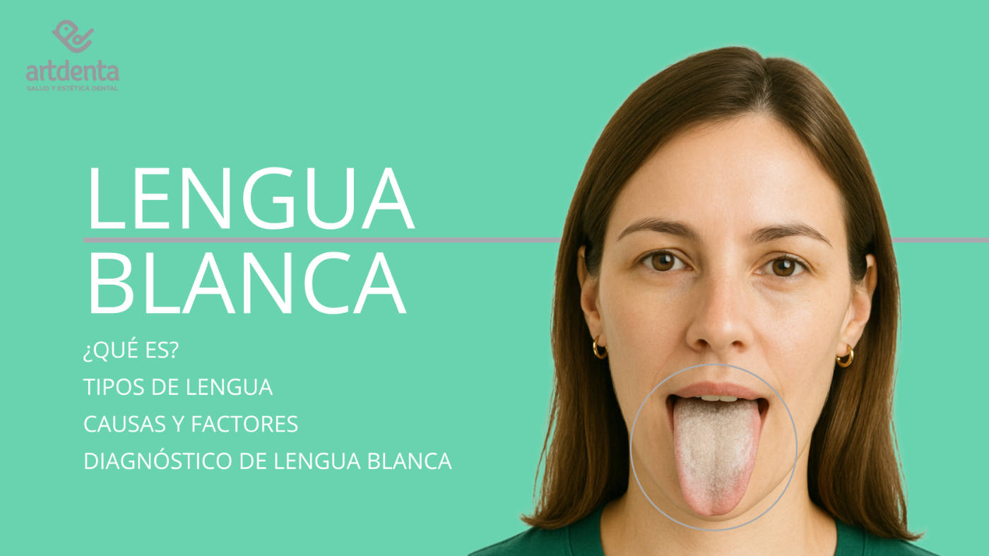 Banner Lengua Blanca | Clínica Dental Artdenta Valencia
