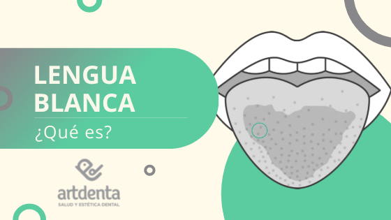 Lengua Blanca Que es | Dental Artdenta Valencia
