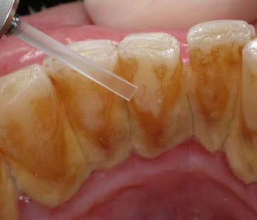 Sarro Dental | Dental Artdenta Valencia