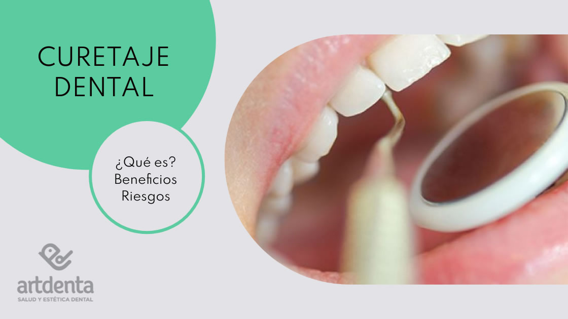 Banner Curetaje Dental | Dental Artdenta Valencia