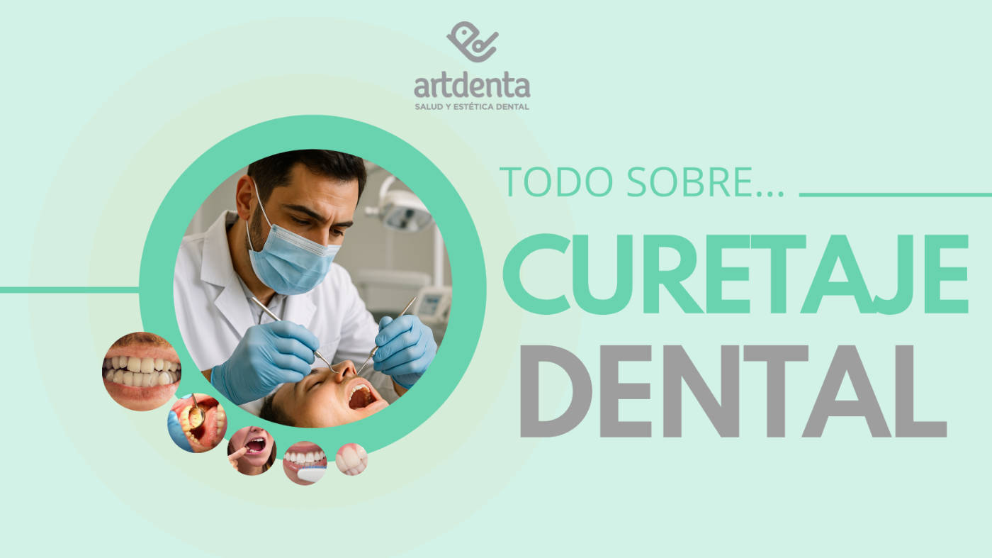 Banner Curetaje Dental | Clínica Dental Artdenta Valencia
