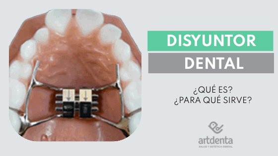 Banner Disyuntor Dental | Clínica Dental Artdenta Valencia