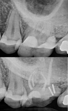 Peno Dental | Clínica Dental Artdenta Valencia