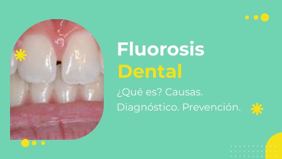 Banner Fluorosis Dental | Clínica Dental Artdenta Valencia
