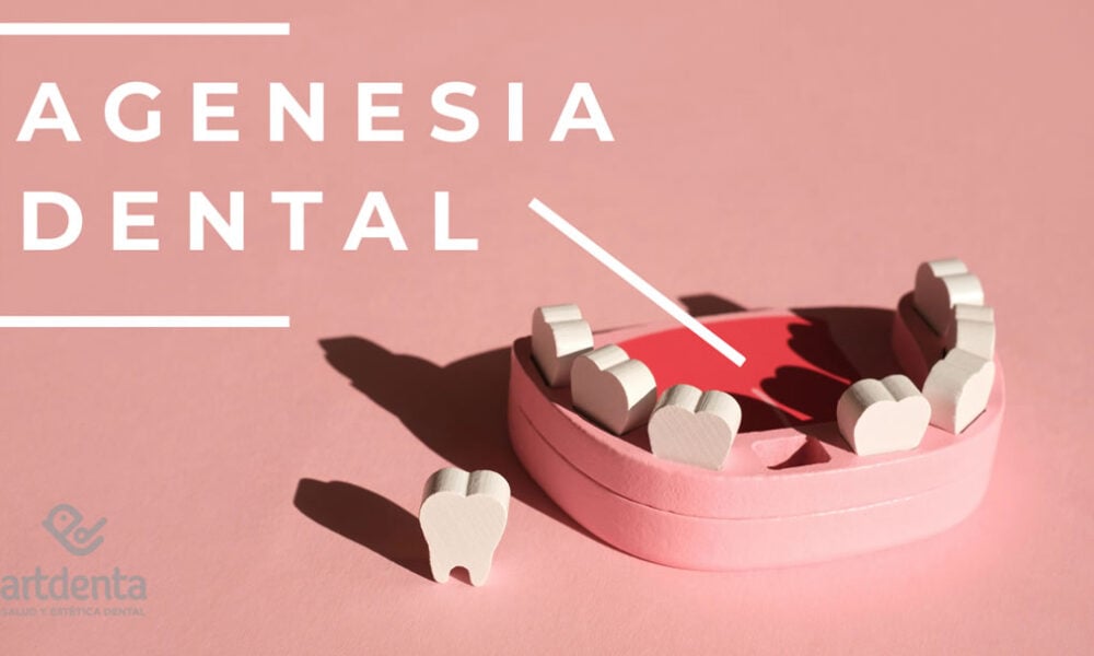 Banner Agenesia Dental | Clínica Dental Artdenta Valencia