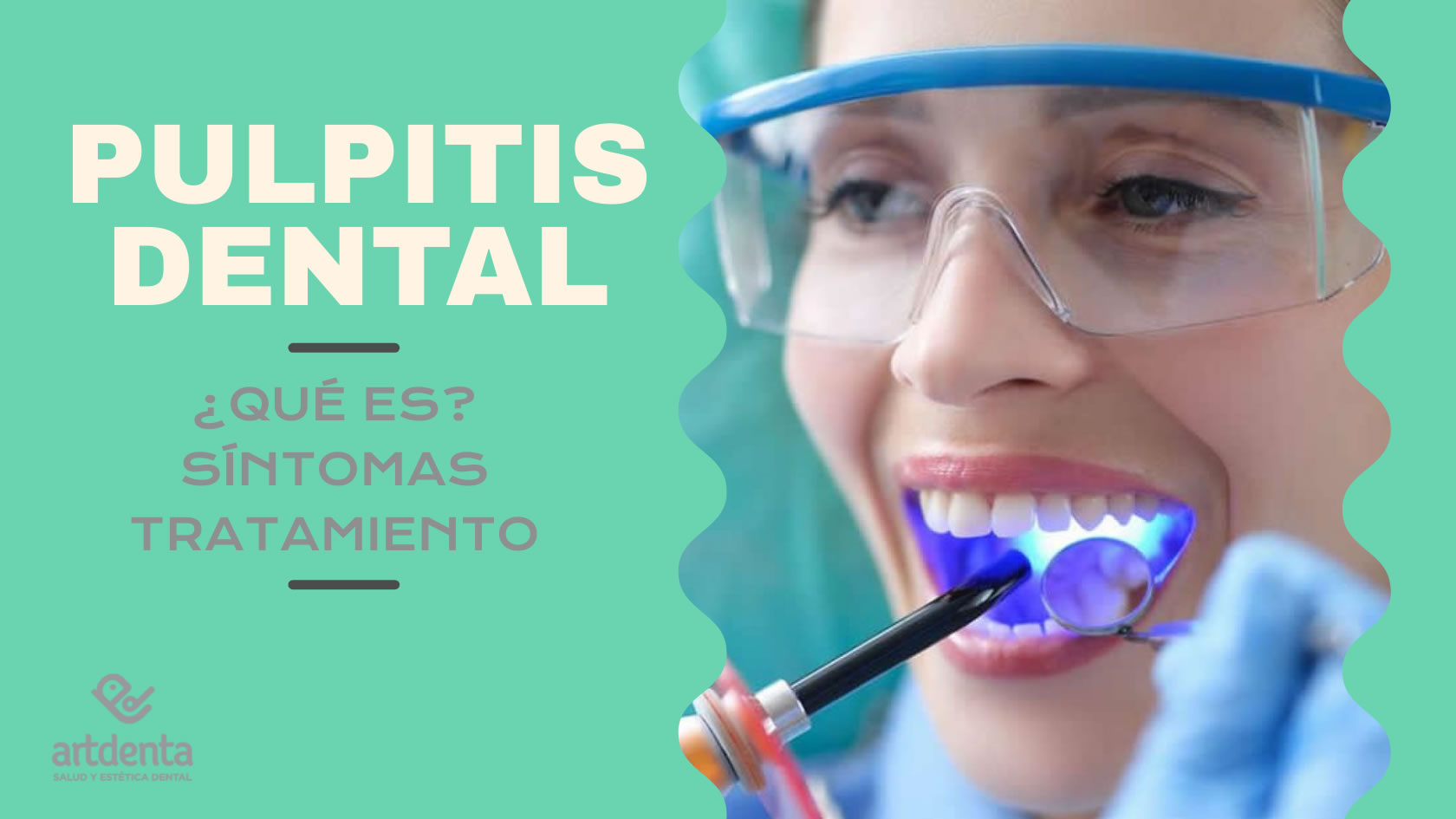 Pulpitis Dental | Clínica Dental Artdenta Valencia