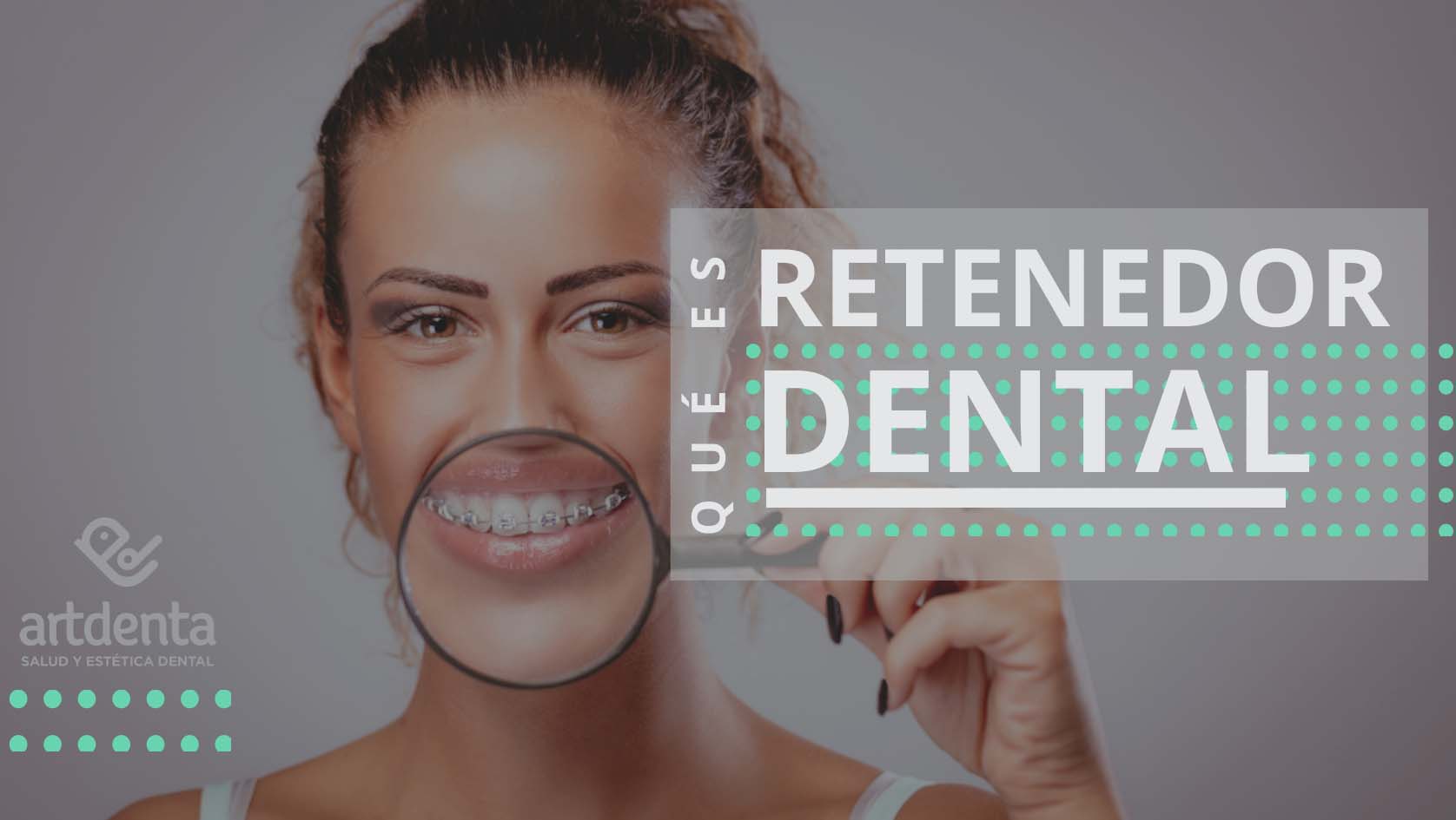 Retenedores dentales 1 Clínica Dental Artdenta Valencia