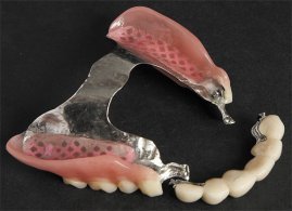Protesis Esquelético Dental | Clínica Dental Artdenta Valencia