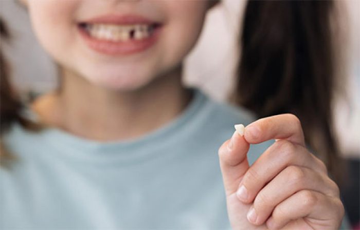 Apiñamiento Dental. ¿Qué es? Causas. Tratamiento. | Clínica Dental en ...