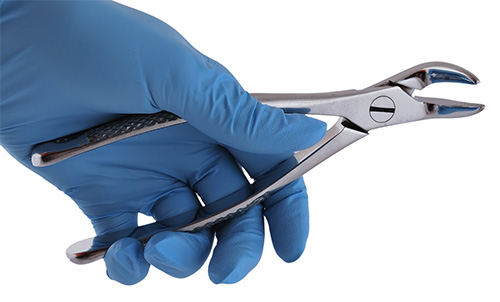 Forceps Dental | Clínica Dental Artdenta Valencia