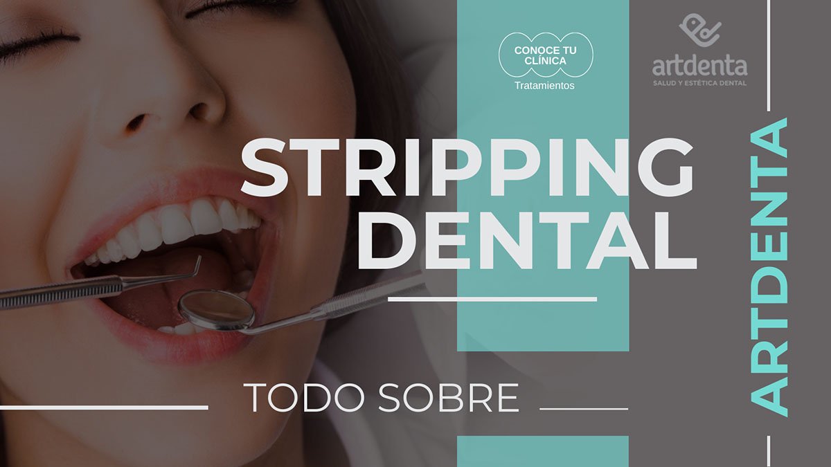 Banner Stripping Dental | Clínica Dental Artdenta Valencia