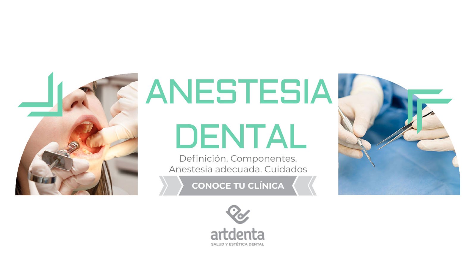 Banner Anestesia Dental | Clínica Dental Artdenta Valencia
