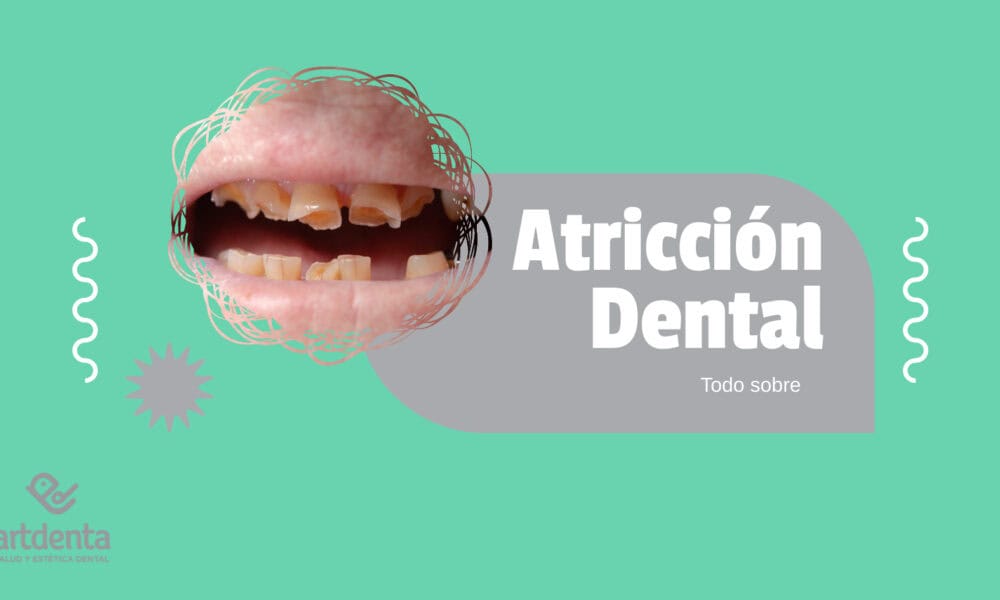 Banner Atricción dental | Clínica Dental Artdenta Valencia
