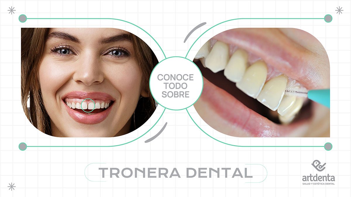 Banner Tronera Dental | Clínica Dental Artdenta Valencia