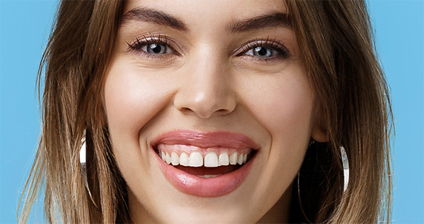 Dientes separados - Tronera Dental | Clínica Dental Artdenta Valencia