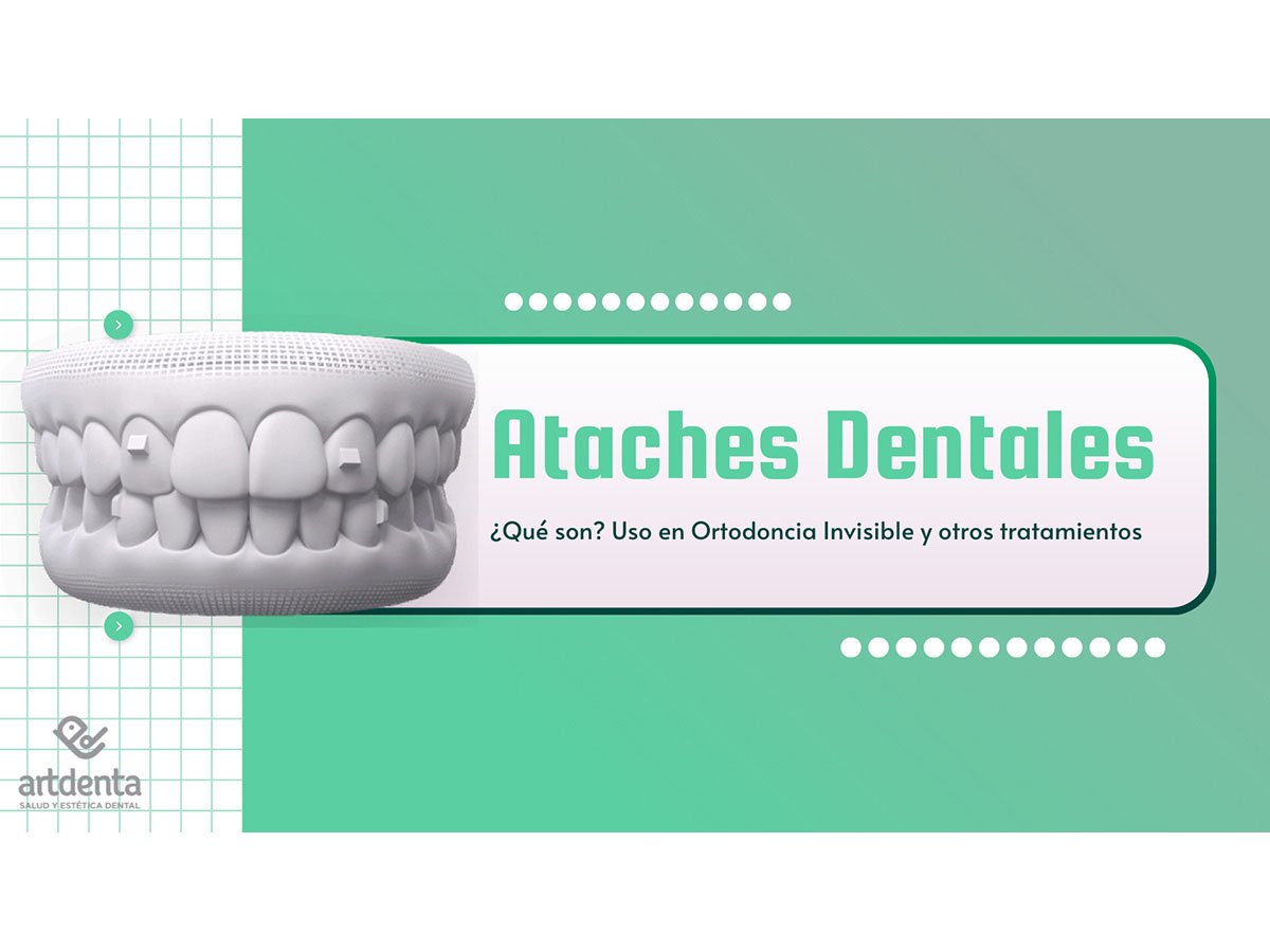 Banner Ataches Dentales | Clínica Dental Artdenta Valencia