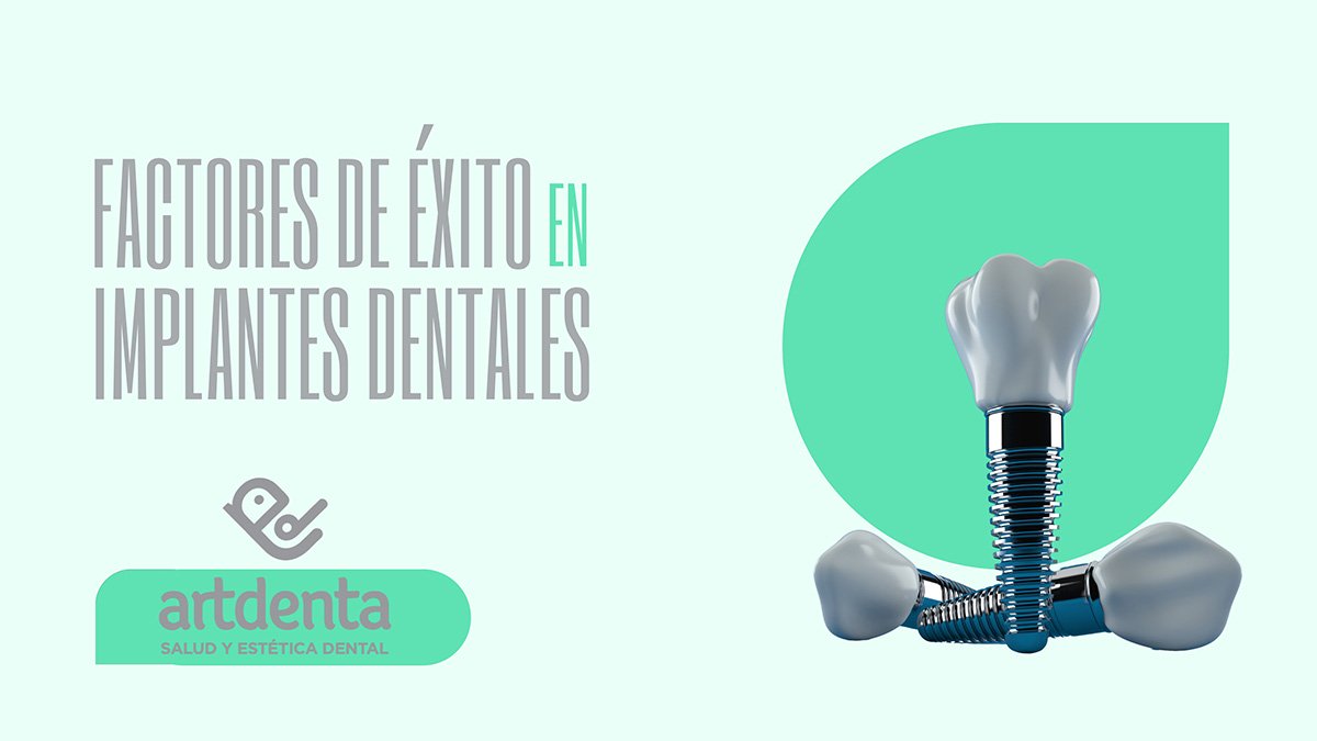 Banner Factores de éxito Implantes Dentales| Clínica Dental Artdenta Valencia