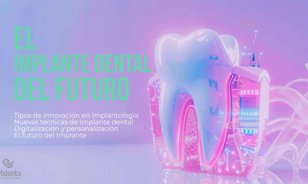 Banner Futuro Implante dental | Clínica Dental Artdenta Valencia