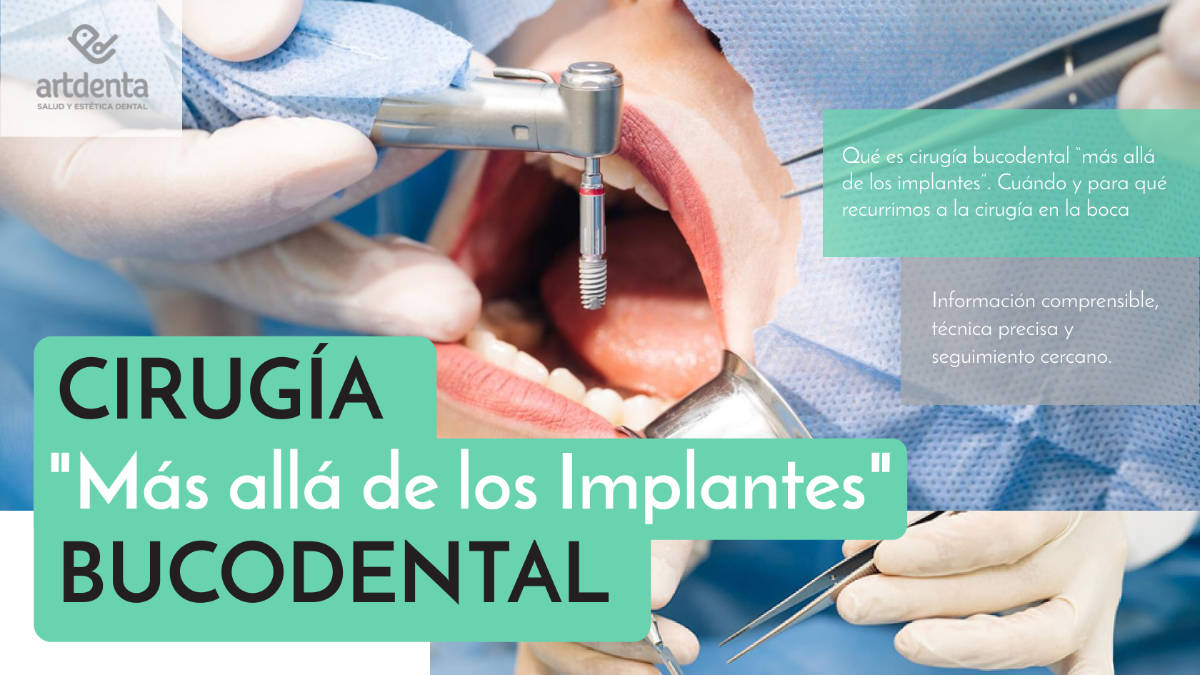 Cirugia Bucodental más allá de los Implantes | Clínica Dental Artdenta Valencia