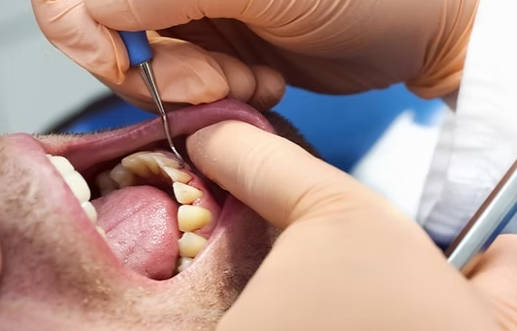 Cirugía Periodontal | Clínica Dental Artdenta Valencia