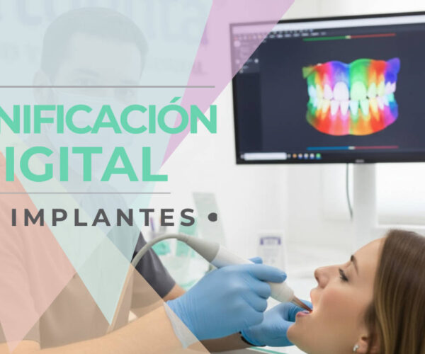 Banner Planificación digital en Implantes Dentales|| Clínica Dental Artdenta Valencia