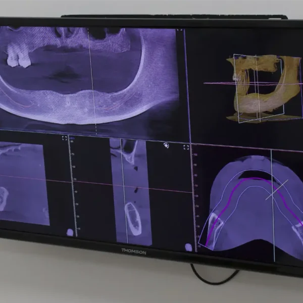 Radiografía Clínica Dental Artdenta Valencia -Benimaclet